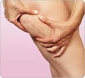cellulite cuisse