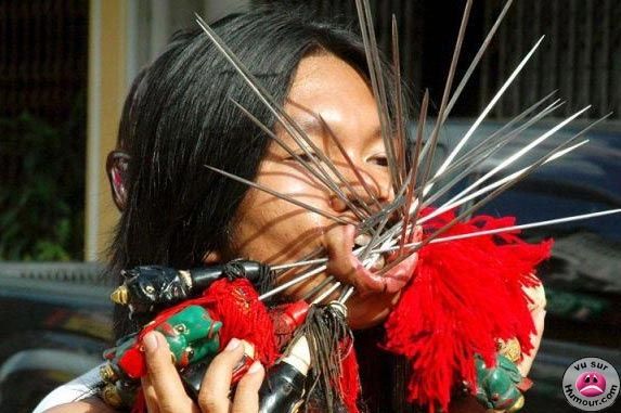 acupuncture-copie-1.jpg