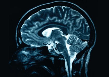 Struttura del cervello