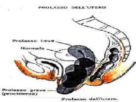schema apparato urinario femminile