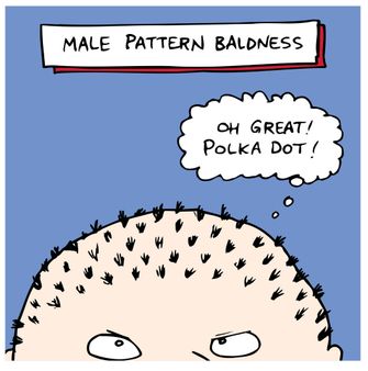Male Pattern Baldness
