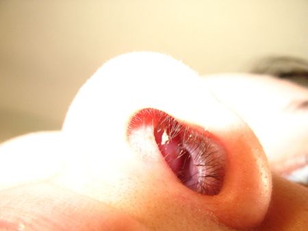 Nose caca