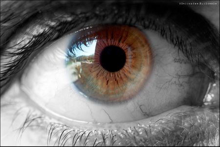 My eye
