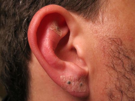 Ear seeds