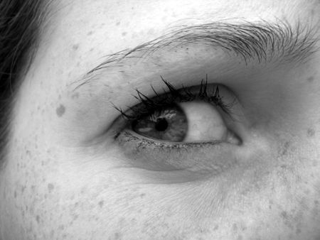 Zodak al tratamiento atopicheskogo de la dermatitis