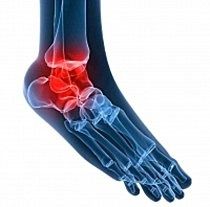 diabete et mal aux pieds diabete et mal aux pieds