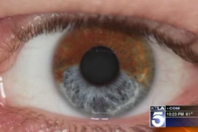 Changer la couleur de ses yeux : c'est maintenant possible grace au laser !  - Le blog de bains-magiques.fr