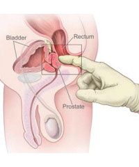 Finding The Male G Spot Prostate Exam Jpg Finding The Male G Spot Prostate Exam Jpg