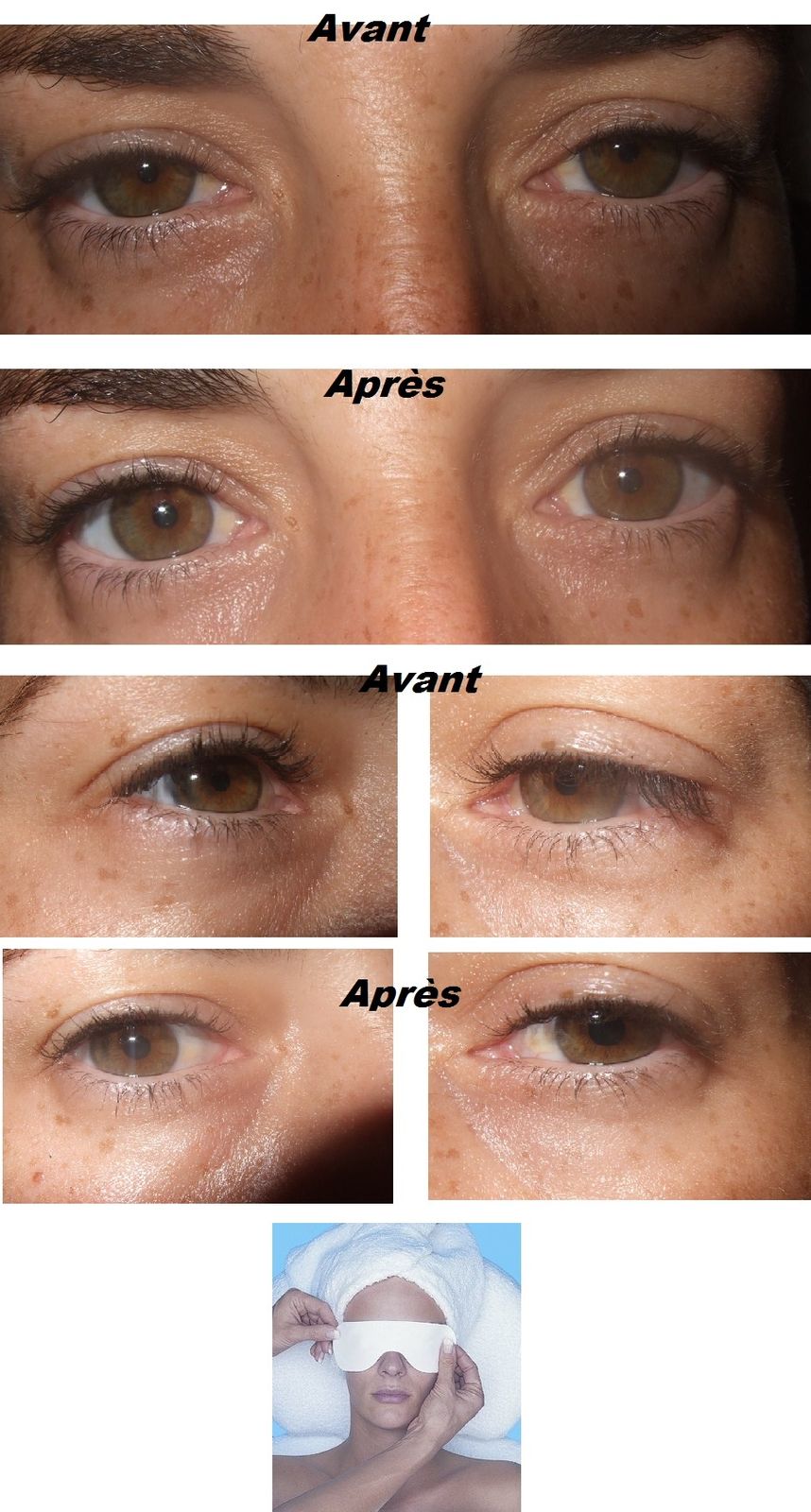 Lalbumine avec la soude le masque pour la personne