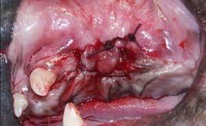 fistule-phase-3.jpg