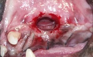 fistule-phase2.jpg