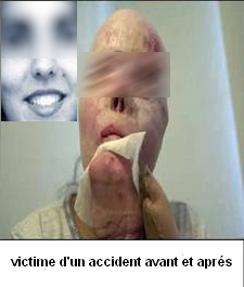 victime-accident-consequence-de-l-alcool_-islam.png