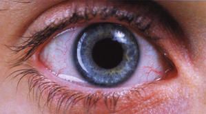oeil.jpg