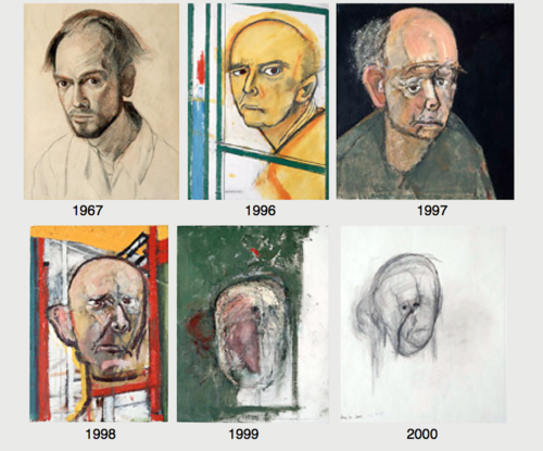 101-William-Utermohlen-Self-Portraits-of-a-Declining-Brain.png