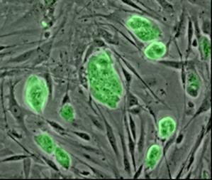 cellules-souches-1.jpg