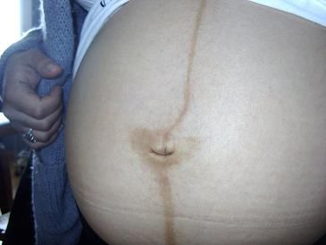 trait de grossesse sur le ventre (3)