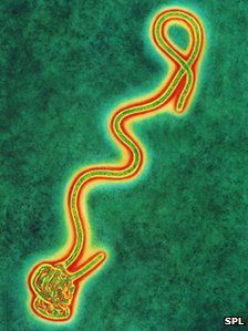 ebola_virus-copie-1.jpg
