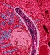 malaria.JPG