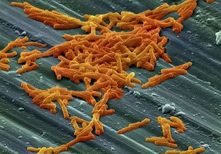 Cdifficile.jpg