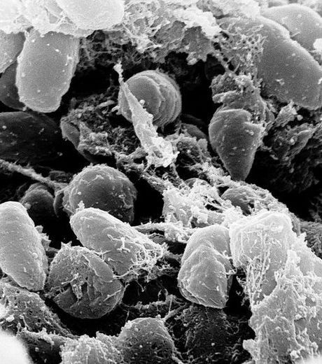 un-groupe-de-bacterie-yersinia-pestis-credits-wikipedia_348.jpg