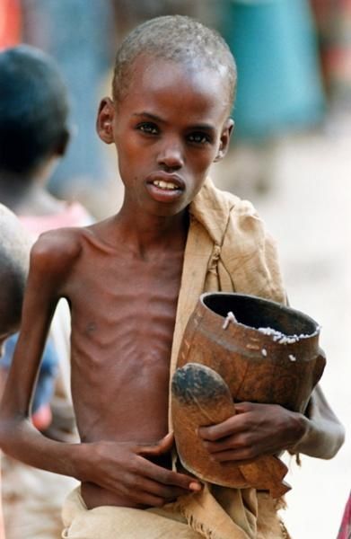 pierreyves-vip-blog-com-594086061226_Somalie_misere_img.jpg