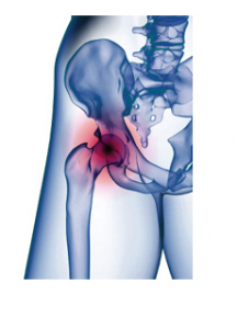technologie_indications_arm-216x300.png